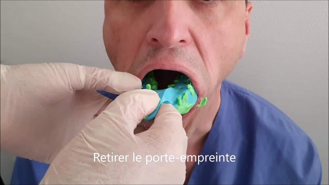 Dentiste ou Denturiste, Denturologue -1