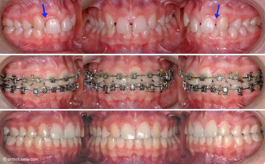 orthodontie